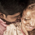 Love Story of an acid attack survivor Award Winning Photography Indian Photographers