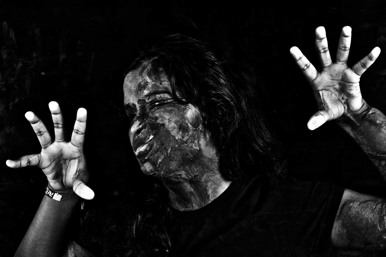 12-trapped-in-acid-attack-india-best-portrait-photographer