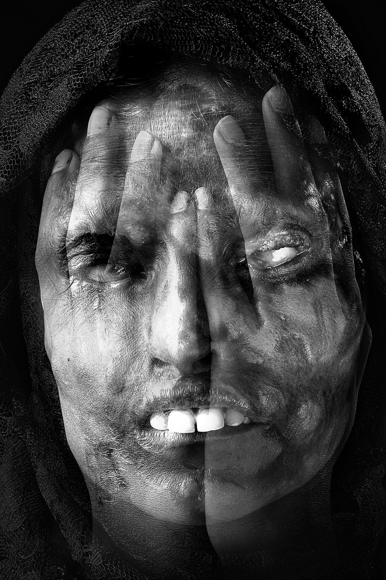 16_acid-attack-creative-best-photographer