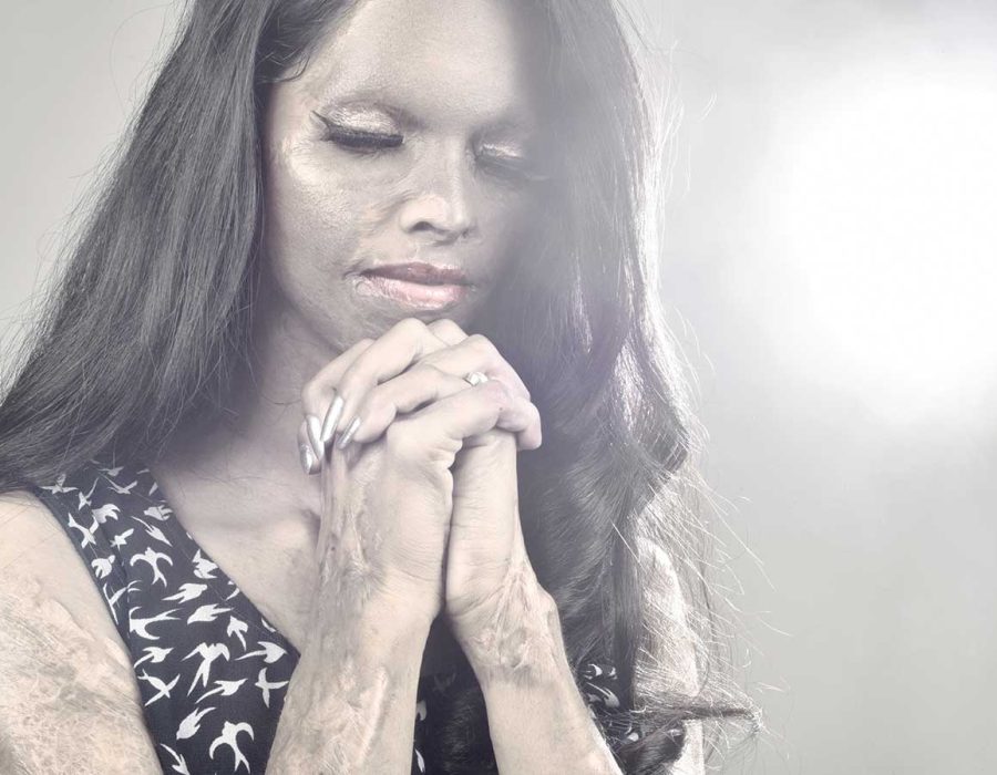 25-acid-attack-survivors-laxmi-prayer-photography