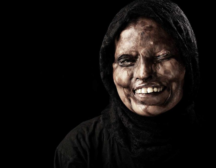30-smile-happy-acid-attack-survivor-neetu