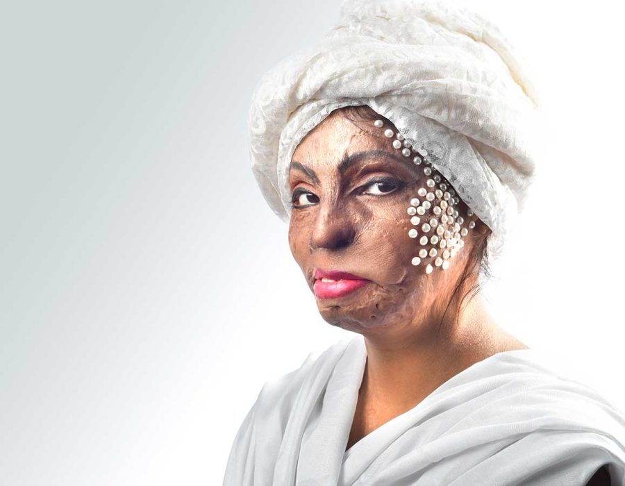 36-rupa-fashion-portfolio-acid-attack-survivor-victim