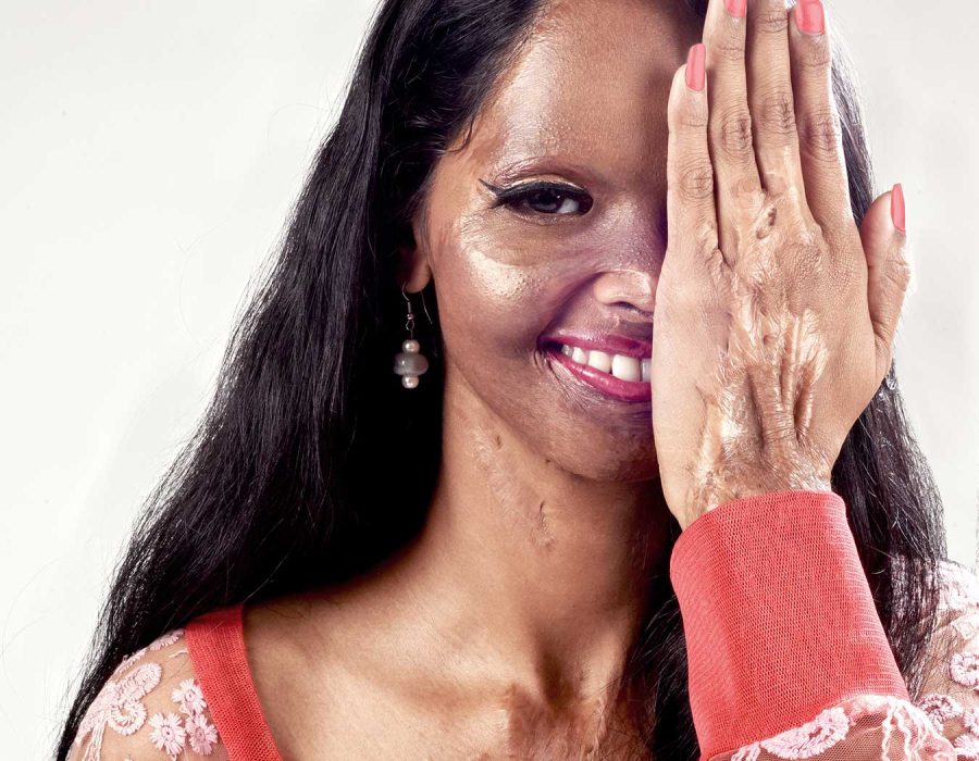 38-beautiful-fashion-laxmi-photographer-acid-attack