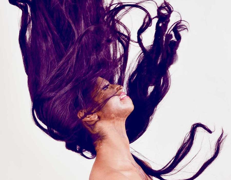 40-fashion-acid-attack-president-award-winner-laxmi-photography